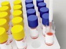 Wheaton CryoELITE™ Cryogenic Vials 