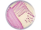 MRSA Infection Control: Issues and Tests
