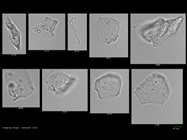 Extending the Limits: Oil Immersion Flow Microscopy