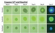  Image-Based, Automated Analysis of 3-D Tumor Spheroids