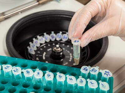  Mini Centrifuge Ergonomics, Specs, and Accessories Chart