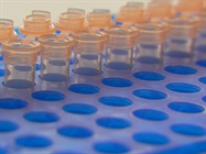 Benchtop Automated PCR Preparation vs Manual PCR Preparation