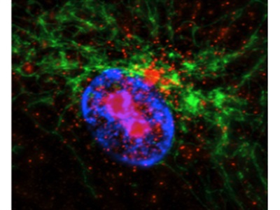 Automated digital microscopy up to 100x