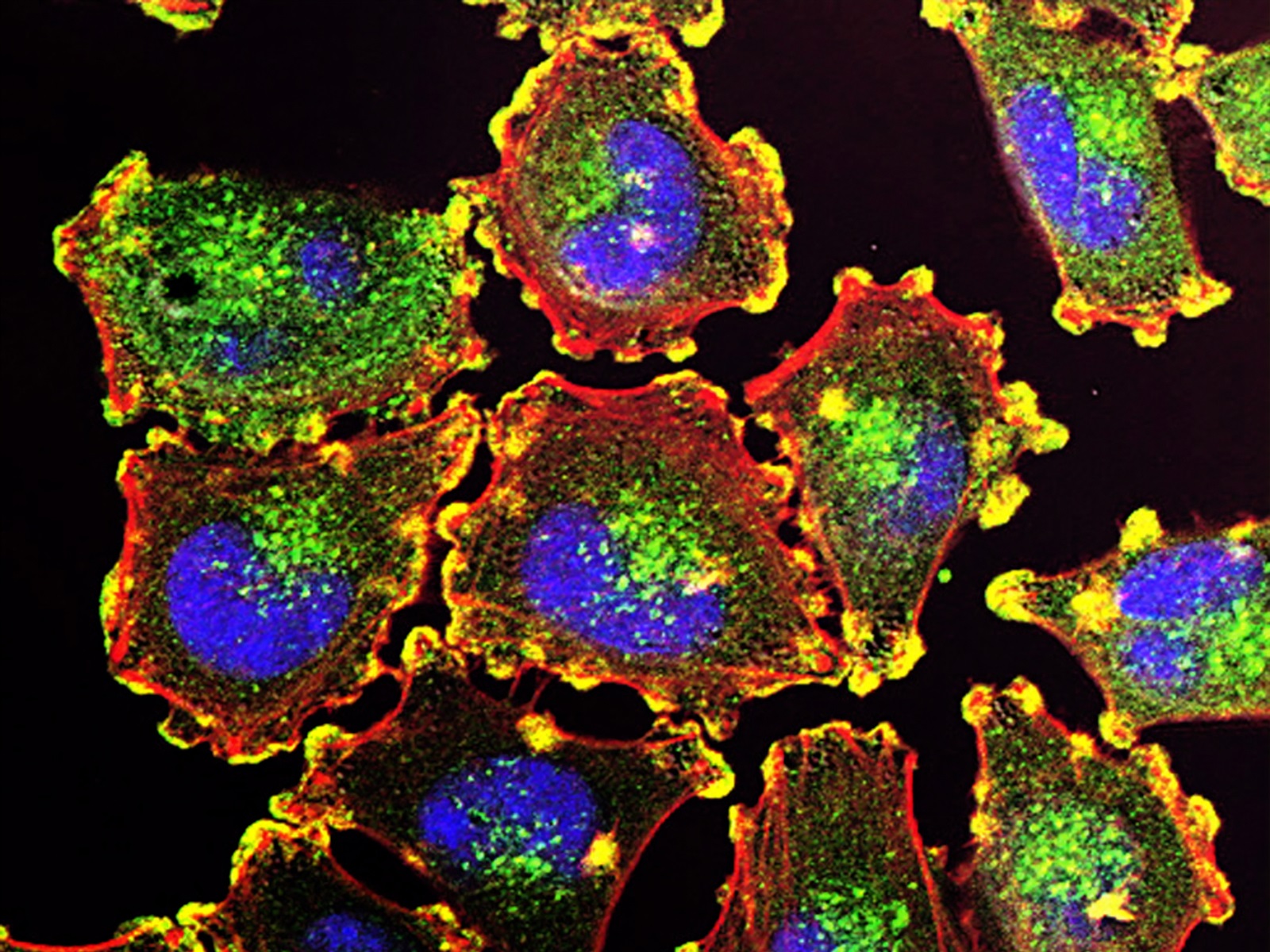  For Cancer Research, Long-Read Sequencing Delivers New Insights