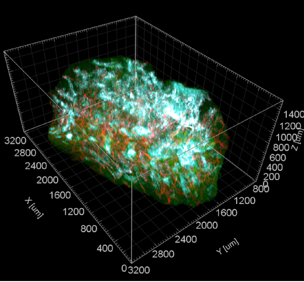 Robust and Innovative LSFM for Large Samples