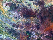 Potential Future Uses for Advanced Hyperspectral Imaging in Medical Settings
