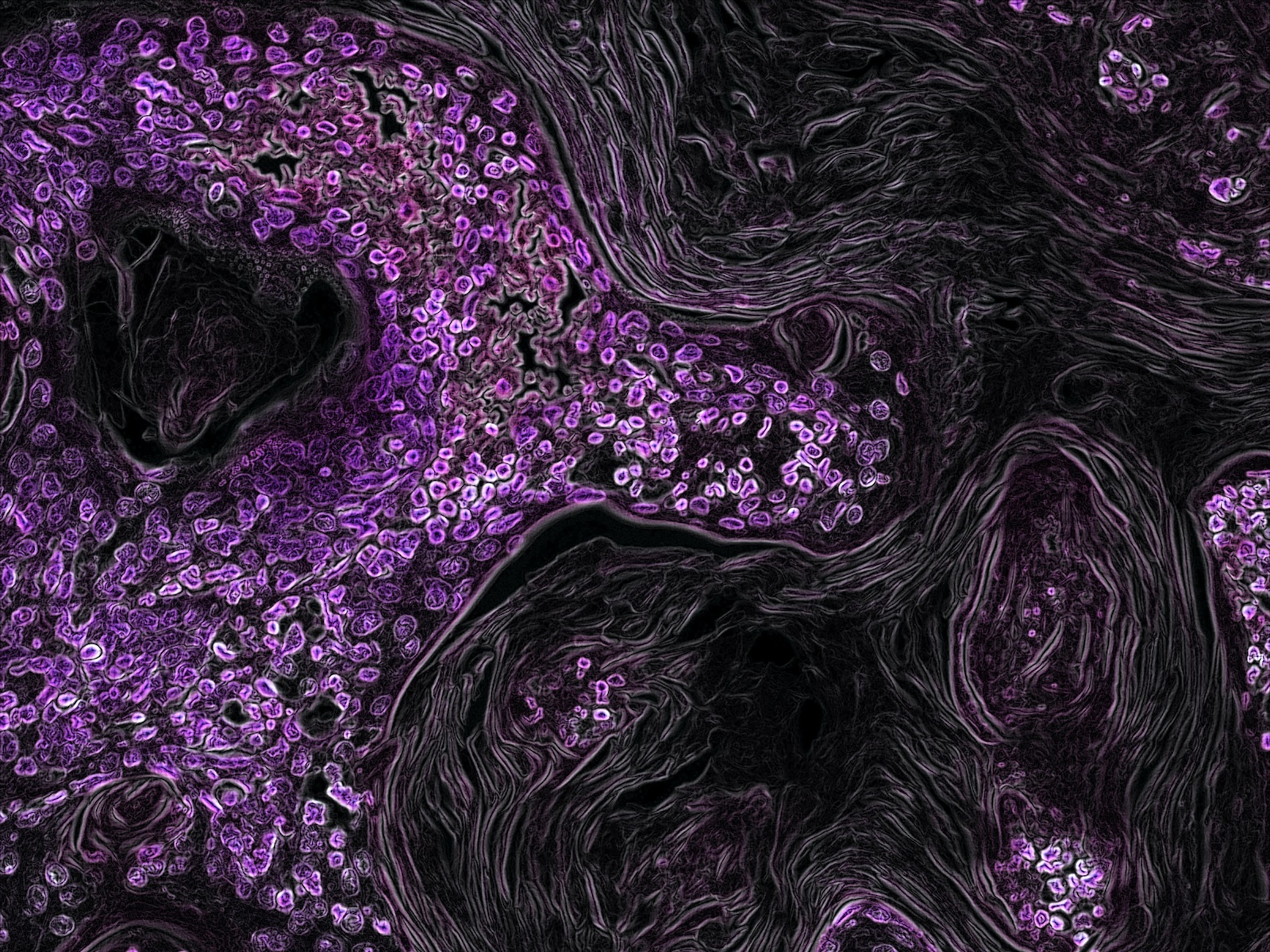  Novel Coronavirus’ Effects on the Respiratory System and Potential Treatment Options