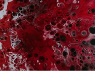 Why Forensic Laboratories Need to Upgrade Their Blood Alcohol Content (BAC) Analysis