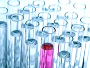 A Guide to Hematology Testing Centrifuges