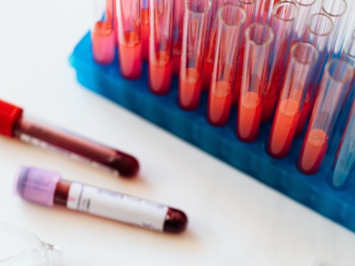 New Nanoantibodies Against SARS-CoV-2 Developed in a Llama