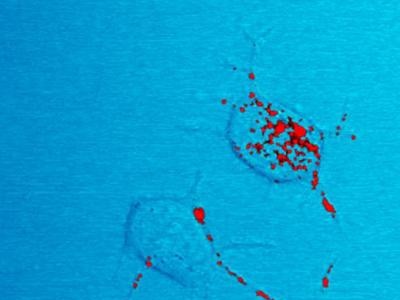 Prion Discovery Helps Advance Neurodegenerative Disease Research