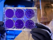  Fantastic Enzymes Discovered in Natural Product Synthesis