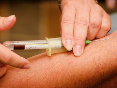 Nitric Oxide as a Powerful COVID-19 Therapeutic
