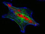 Neural circuit
