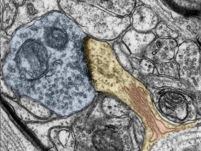 Vitamin A and Its Role in Nerve Cell Neuroplasticity