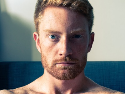 Why Do Redheads Have Higher Pain Tolerances?