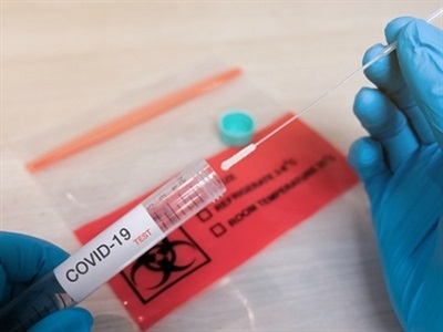 SARS-CoV-2 RNA Virus Detection from Saliva Samples