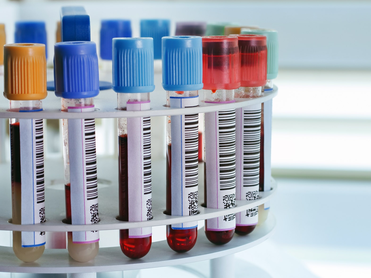 Four Questions to Guide Your Laboratory Centrifuge Selection