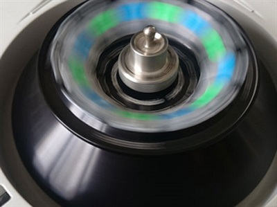 A Disaster Waiting to Happen: Why Not Getting an Ultracentrifuge Service Contract is Like a Ticking Bomb
