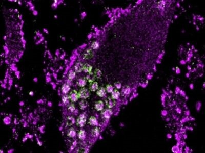 Flipping Gene Switches Reveals Unexpected Results