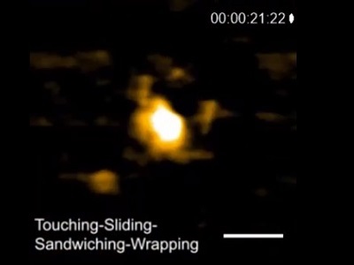 Unraveling DNA Packaging