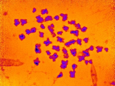 Mass of Human Chromosomes Measured for First Time