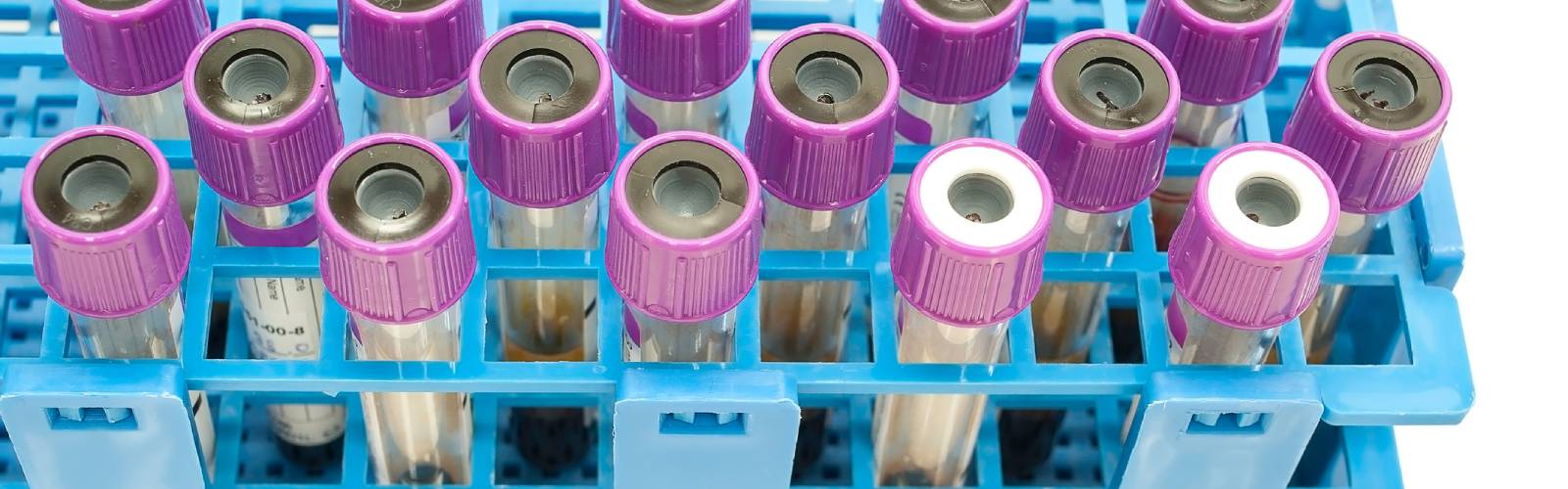 Q&A: Ask a Flow Cytometry Expert