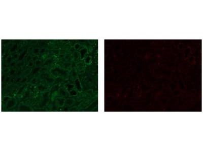 How to Reduce Autofluorescence