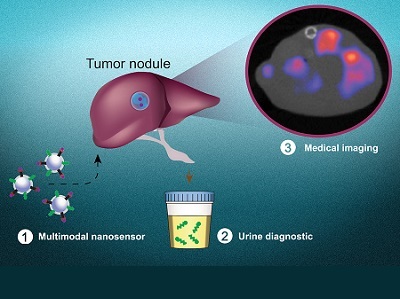  Noninvasive Test to Detect Cancer Cells, Pinpoint their Location