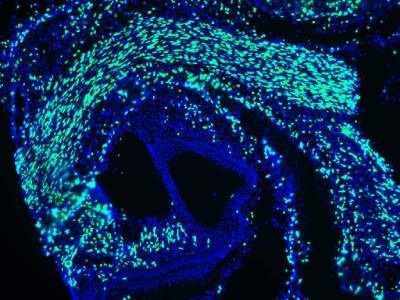 Works Well for In Vivo EdU Incorporation and Detection