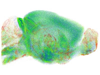 New Tool Allows High-resolution Imaging of Whole Brains
