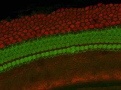 Great Antibody for Sox9 Staining