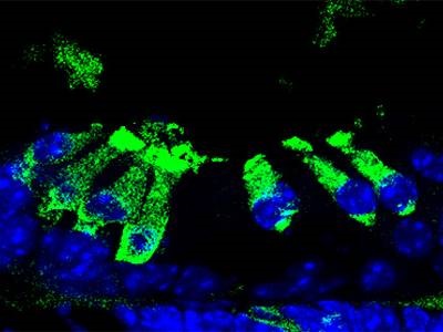 Excellent Mouse Myo7a Antibody