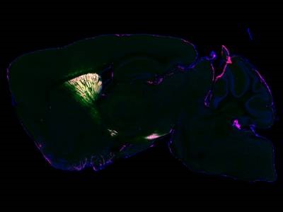 New Technique Identifies Proteins in Living Brain
