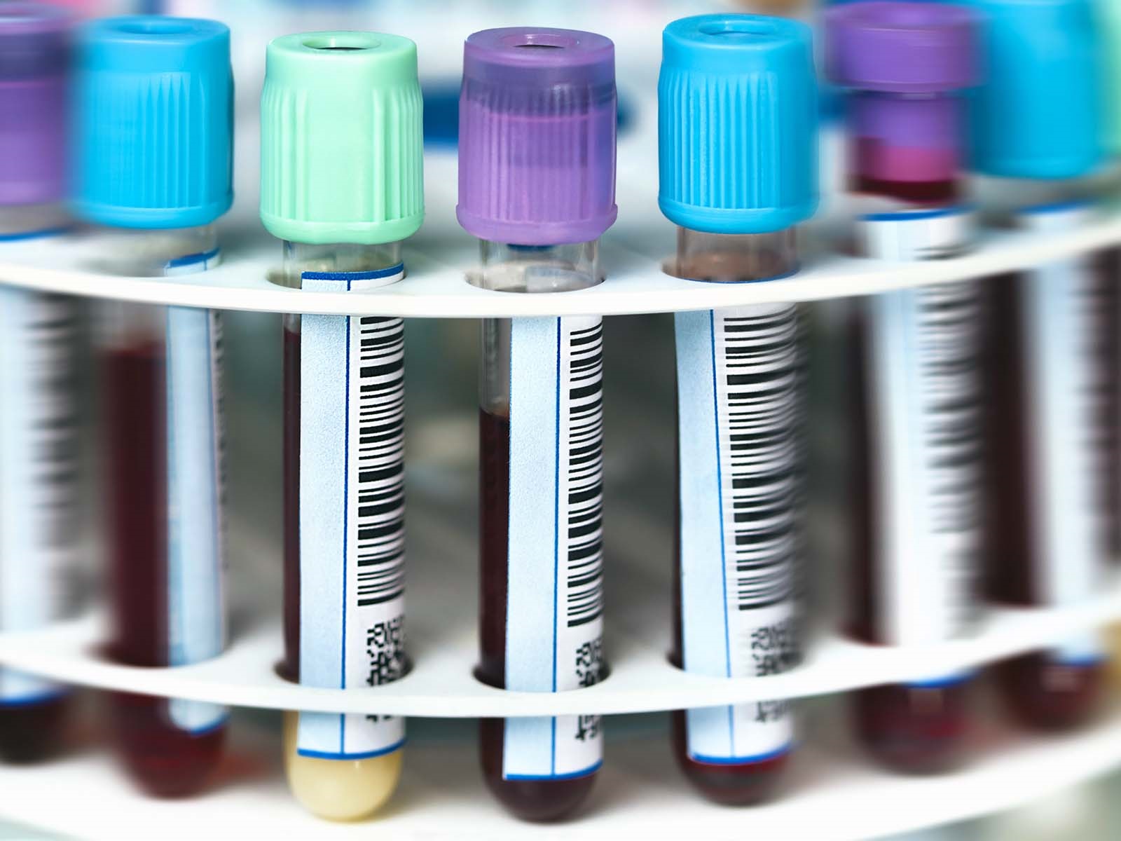  How to Maximize the Performance and Life of your Centrifuge