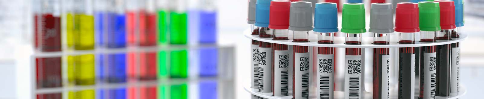  Centrifuge Buyer's Guide: 7 Questions to Optimize Performance