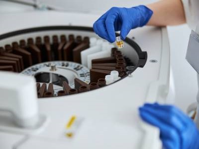Buyer’s Guide: Clinical Chemistry Analyzers for Opioid Screening