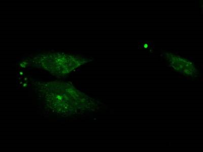 Highly Recommended GFP Antibody