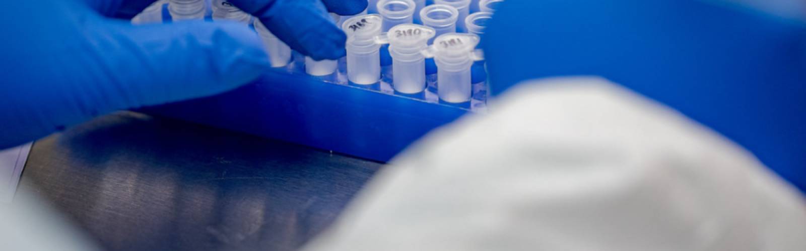  COVID-19 Wastewater Testing: Overview and Product Roundup