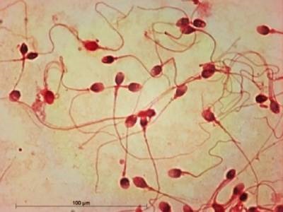 Forensic Researchers Develop New Tool for Spotting Sperm Under Microscope