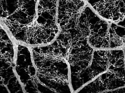 Dye-less Method Maps Capillary Blood Flow Down to 1 Blood Cell