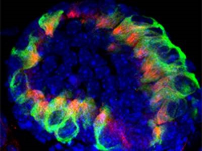 ‘Hairy’ Cochlear Organoids Reveal Drug Candidate for Hearing Loss