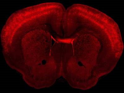 Researchers Publish Comprehensive Atlas of Primary Motor Cortex