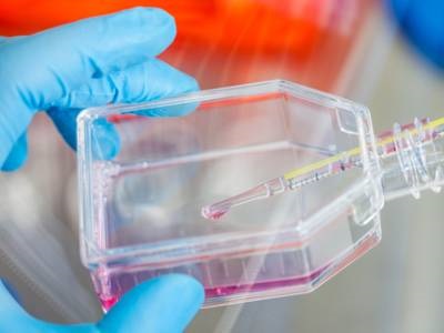  Adherent or Suspension? How to Select the Right Production Method for Your Cell Culture Process