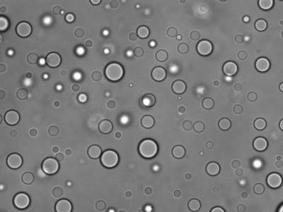 Unlocking the Code Behind Viscoelasticity in Protein-RNA Droplets