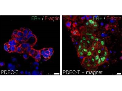 Gel-grown Breast Cancer Models Could Advance Hormone Therapies