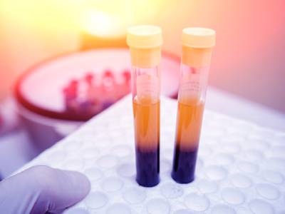 3D Printed Blood Plasma May Speed Up Wound Healing