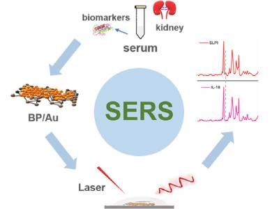 From Lab to Hospital: SERS Spectroscopy Could Aid in Kidney Transplants
