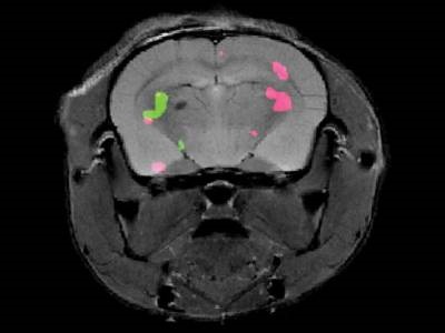 Dual-color MRI Can Track Gene Expression