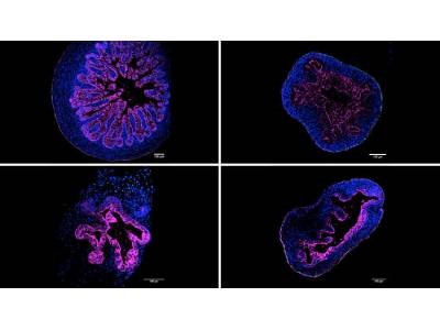 Researchers Discover Simpler Way to Grow Intestinal Organoids